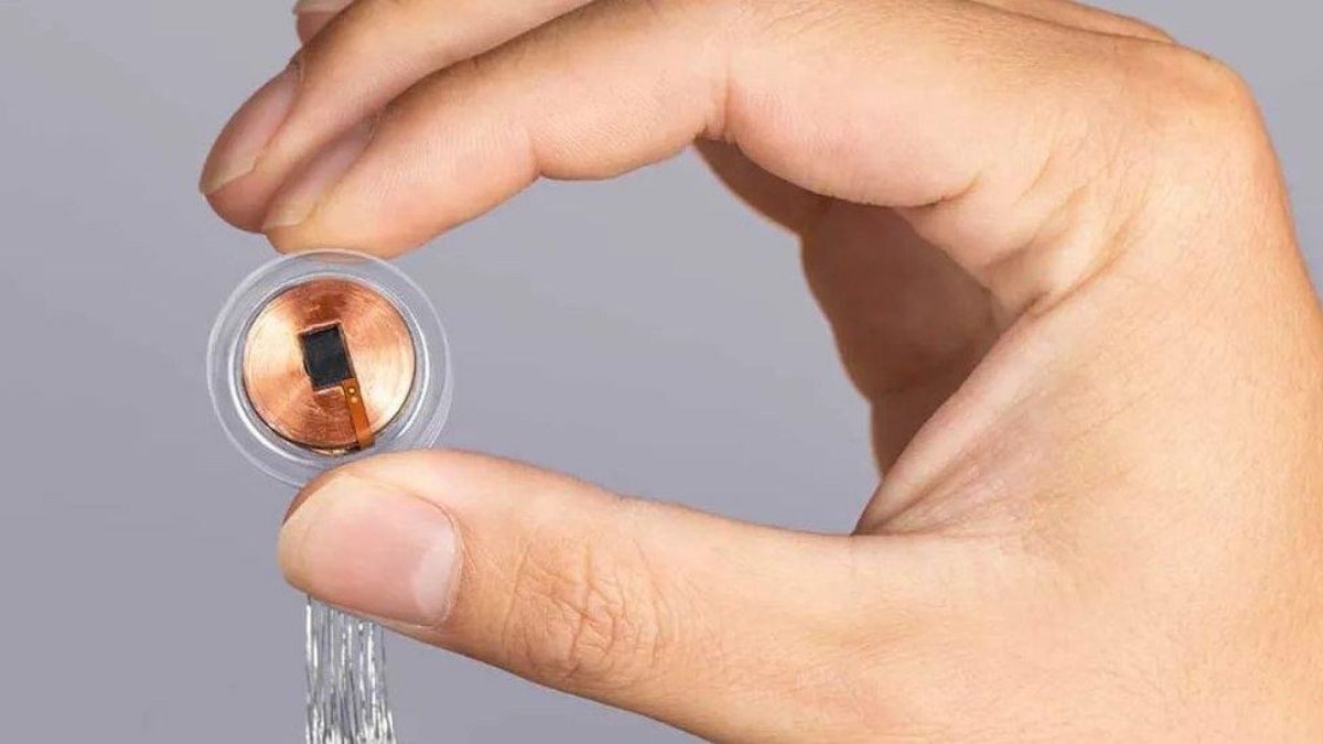 Neuralink 2026'da yüksek hacimli üretime başlıyor 31 Neuralink 2026'da yüksek hacimli üretime başlıyor